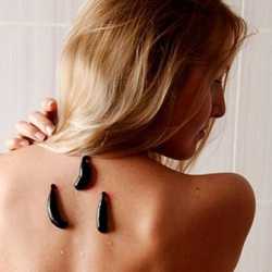 Hirudoterapia (pijawki) 1 sesja